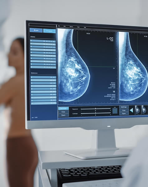 fig-mamografia-1